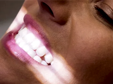 Işıl Diş sosyal medya yönetimi